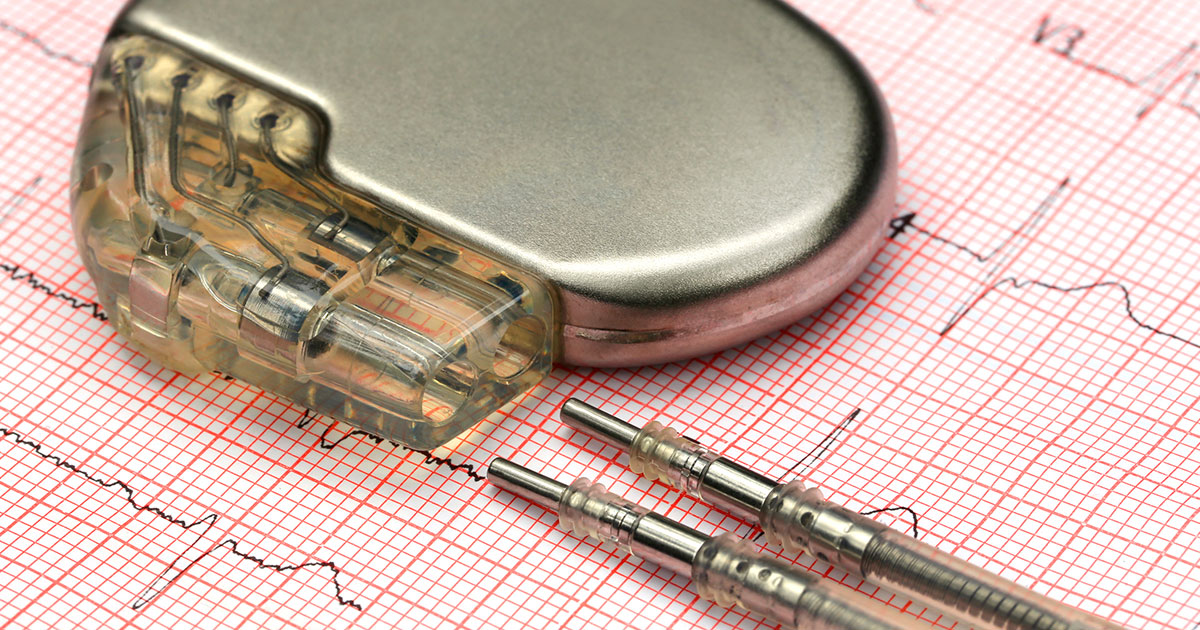 pacemaker-for-afib-how-they-work-and-questions-for-your-doctor